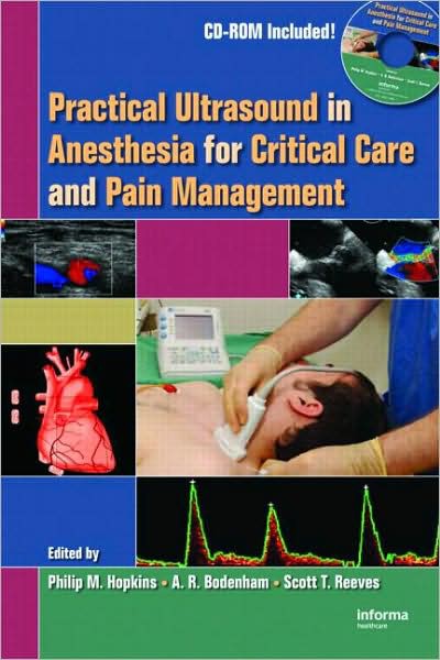 Practical Ultrasound in Anesthesia for Critical Care and Pain Management