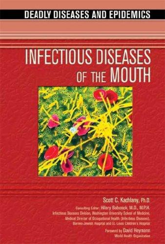 Infectious Diseases of the Mouth